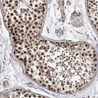 Immunohistochemical staining of human testis shows strong nuclear positivity in cells in seminiferous ducts.