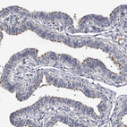 Immunohistochemical staining of human fallopian tube shows strong positivity in cilia in glandular cells.