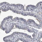 Immunohistochemical staining of human fallopian tube shows strong positivity in cilia in glandular cells.