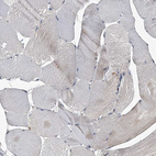 Immunohistochemical staining of human skeletal muscle shows no positivity in myocytes as expected.