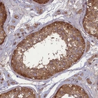 Immunohistochemical staining of human testis shows strong cytoplasmic positivity in cells in seminiferous ducts.