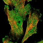 Immunofluorescent staining of human cell line U-251 MG shows localization to nucleoplasm & cytosol.