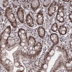 Immunohistochemical staining of human duodenum shows strong nuclear positivity in glandular cells.