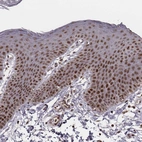 Immunohistochemical staining of human skin shows strong nuclear positivity in squamous epithelial cells.