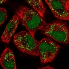 Immunofluorescent staining of human cell line A549 shows localization to nucleus, nucleoli & vesicles.