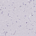 Immunohistochemical staining of human cerebral cortex shows no positivity in neurons as expected.