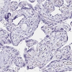 Immunohistochemical staining of human placenta shows no positivity in trophoblastic cells as expected.