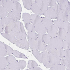 Immunohistochemical staining of human skeletal muscle shows no positivity in myocytes as expected.