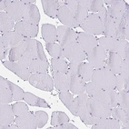 Immunohistochemical staining of human skeletal muscle shows no positivity in myocytes as expected.