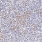 Immunohistochemical staining of human tonsil shows moderate cytoplasmic positivity in non-germinal center cells.