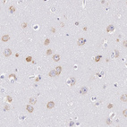 Immunohistochemical staining of human cerebral cortex shows moderate cytoplasmic positivity in neurons.