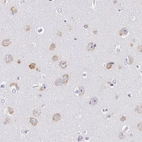 Immunohistochemical staining of human cerebral cortex shows moderate cytoplasmic positivity in neurons.