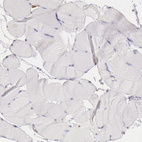 Immunohistochemical staining of human skeletal muscle shows no positivity in myocytes as expected.