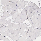 Immunohistochemical staining of human skeletal muscle shows no positivity in myocytes as expected.