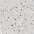 Immunohistochemical staining of human cerebral cortex shows strong cytoplasmic granular positivity in neurons.