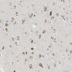 Immunohistochemical staining of human cerebral cortex shows strong cytoplasmic granular positivity in neurons.