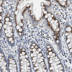 Immunohistochemical staining of human rectum shows strong cytoplasmic granular positivity in glandular cells.