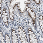 Immunohistochemical staining of human rectum shows strong cytoplasmic granular positivity in glandular cells.