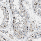 Immunohistochemical staining of human testis shows strong cytoplasmic granular positivity in cells in seminiferous ducts.