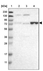 Lane 1: Marker [kDa] 230, 130, 95, 72, 56, 36, 28, 17, 11_br/_Lane 2: Human cell line RT-4_br/_Lane 3: Human cell line U-251MG sp_br/_Lane 4: Human plasma (IgG/HSA depleted)