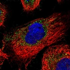 Immunofluorescent staining of human cell line A-431 shows localization to vesicles.