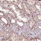 Immunohistochemical staining of human kidney shows strong nuclear positivity in cells in tubules.