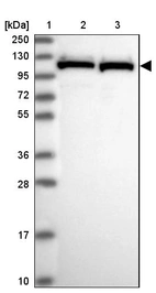 Lane 1: Marker [kDa] 250, 130, 95, 72, 55, 36, 28, 17, 10_br/_Lane 2: Human cell line RT-4_br/_Lane 3: Human cell line U-251MG sp