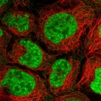 Immunofluorescent staining of human cell line CACO-2 shows localization to nuclear speckles.