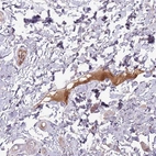 Immunohistochemical staining of human skin shows strong positivity in plasma.