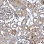Immunohistochemical staining of human kidney shows moderate cytoplasmic positivity in cells in tubules.