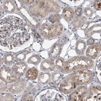 Immunohistochemical staining of human kidney shows moderate cytoplasmic positivity in cells in tubules.