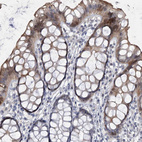 Immunohistochemical staining of human rectum shows strong cytoplasmic positivity in glandular cells.