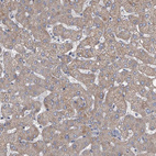 Immunohistochemical staining of human liver shows moderate cytoplasmic positivity in hepatocytes.