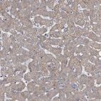 Immunohistochemical staining of human liver shows moderate cytoplasmic positivity in hepatocytes.