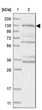 Lane 1: Marker [kDa] 230, 130, 95, 72, 56, 36, 28, 17, 11_br/_Lane 2: Human cell line RT-4