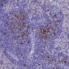 Immunohistochemical staining of human lymph node shows strong cytoplasmic positivity in non-germinal center cells.