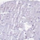 Immunohistochemical staining of human skeletal muscle shows no positivity in myocytes as expected.