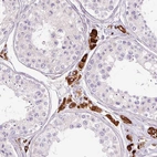 Immunohistochemical staining of human testis shows strong cytoplasmic positivity in Leydig cells.