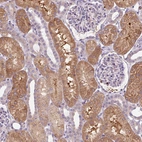 Immunohistochemical staining of human kidney shows strong cytoplasmic positivity in cells in tubules.