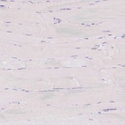 Immunohistochemical staining of human skeletal muscle shows no positivity in myocytes as expected.