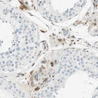 Immunohistochemical staining of human testis shows strong cytoplasmic positivity in Leydig cells.