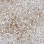 Immunohistochemical staining of human liver shows strong cytoplasmic positivity in hepatocytes.