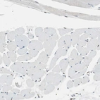 Immunohistochemical staining of human skeletal muscle shows no positivity in myocytes as expected.