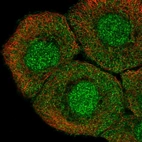 Immunofluorescent staining of human cell line HaCaT shows localization to nucleus & cytosol.