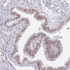 Immunohistochemical staining of human fallopian tube shows moderate nuclear/nuclear membranous positivity in glandular cells.