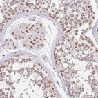 Immunohistochemical staining of human testis shows moderate nuclear/nuclear membranous positivity in Leydig cells and cells in seminiferous ducts.