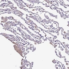 Immunohistochemical staining of human lung shows moderate cytoplasmic positivity in macrophages.