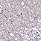 Immunohistochemical staining of human kidney shows moderate cytoplasmic positivity in cells in tubules.