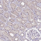 Immunohistochemical staining of human kidney shows moderate cytoplasmic positivity in cells in tubules.