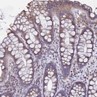 Immunohistochemical staining of human colon shows strong cytoplasmic positivity in glandular cells.